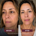 Aurebi Eye Recovery Therapy